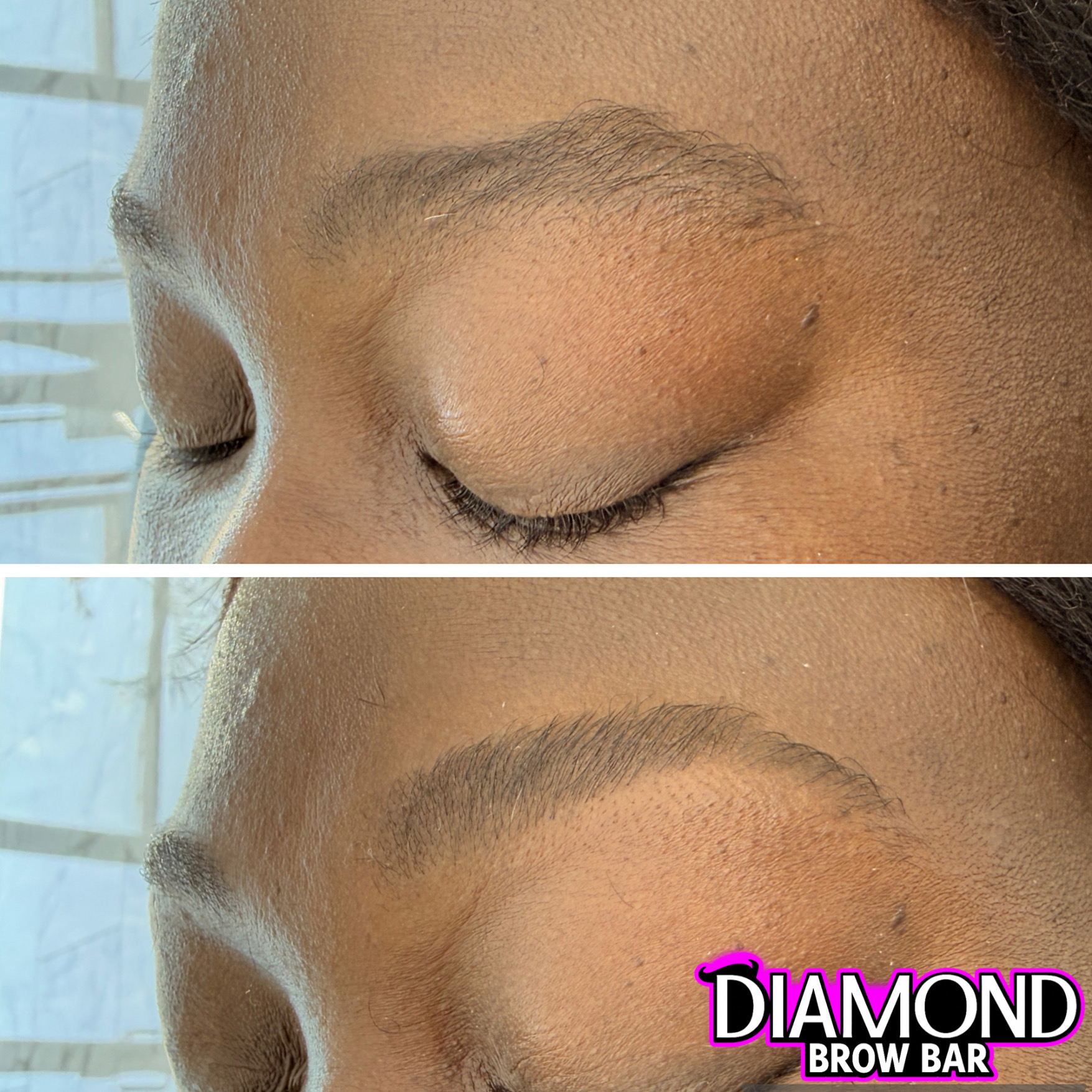 Brow transformation 2